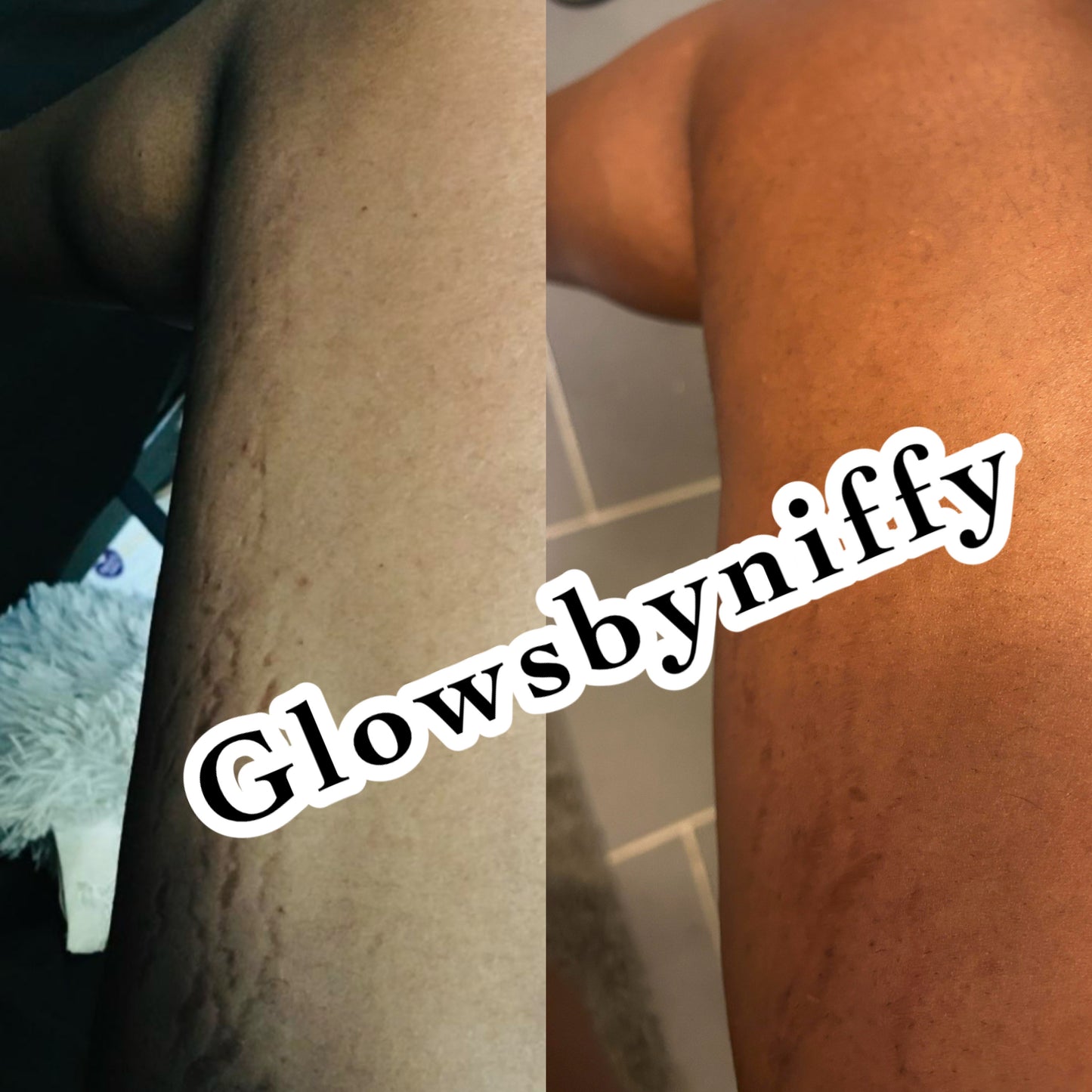 Wholesale 128oz 1 Gallon Pfat stretch marks and scar oil